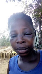 Rebecca Nyukeh battered in police custody